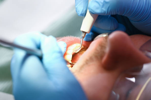Best Emergency Treatment for Oral Infections in East Cleveland, TN