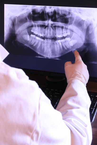 Best Emergency Denture Repair in East Cleveland, TN